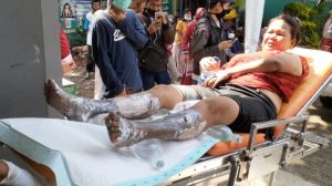 Tambal Ban Terbakar Tiga Orang Terluka Bakar