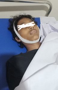 Seorang Pelajar SMP Tewas Di Bacok Dua Orang Tidak Di Kenal
