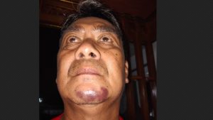 Jadi Korban Penggeroyokan di Satriajaya, Pengawas Perumahan Lapor Polisi