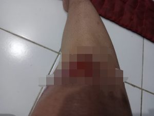 Begal Makin Marak,Karyawan Kembali Jadi Korban