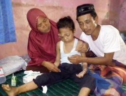 Gadis Belia Penderita Tumor Ganas Harapkan Uluran Tangan Pemerintah dan Warga