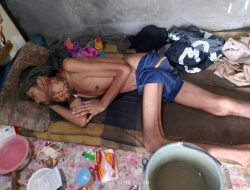 Warga Sukaindah Kab Bekasi Harapkan Bantuan Untuk Pengobatan Penyakit Tumor Ganas, di Deritanya